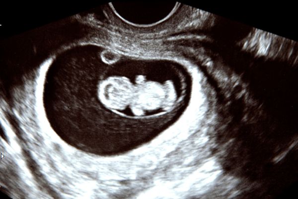 Stress, Fertility, and the Nervous System: How Chiropractic Care Can Help